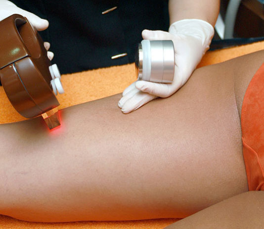 Pakiet usług depilacji uzupełniony dodatkowymi zabiegami